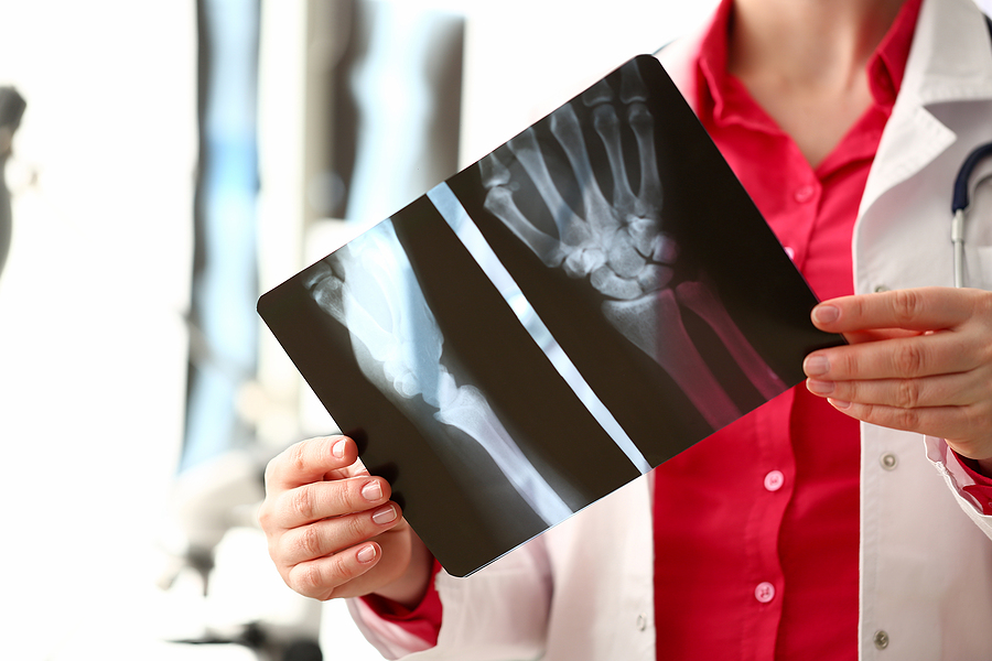 Female radiologist hold in hand x-ray film